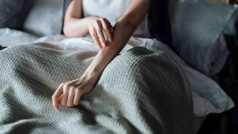 A pikkelysömör csak a száraz bőr következménye? - 8 tévhit, amit lehet, hogy te is rosszul tudtál