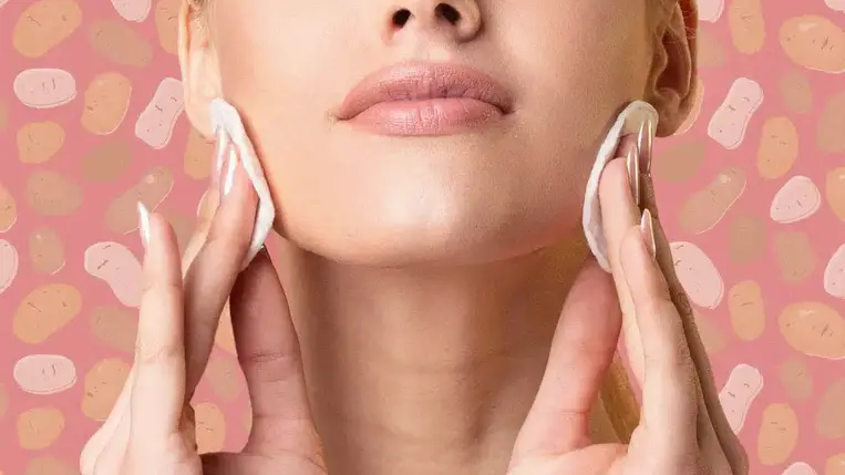  Tényleg csodát tesz a krumpli a pattanásos bőrrel? Utánajártunk! 