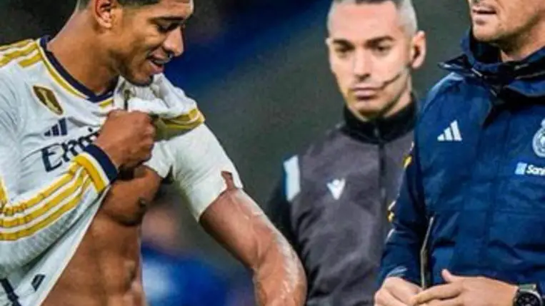 Megsérült a Real Madrid sztárja