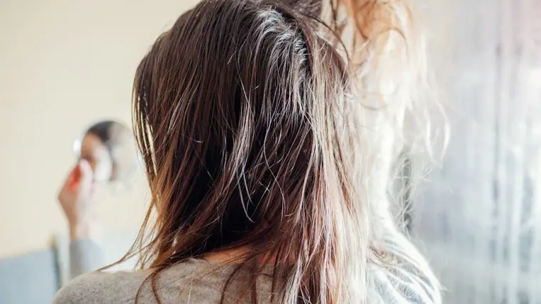 Ilyen ápolást igényel a gyorsan zsírosodó haj