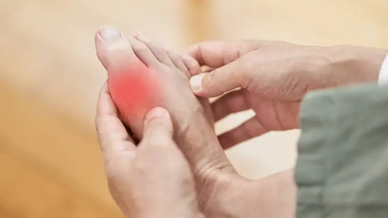 Rohamokban jelentkező erős ízületi fájdalmat okoz ez a betegség