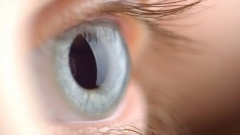 Kárpátalján három egészségügyi intézmény kínál ingyenes műlencse-beültetést. Illusztráció. Fotó: Internet