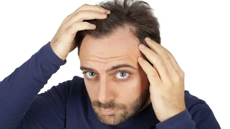 Megvan a kopaszodás ellenszere – ezt kell tenni a kutatók szerint