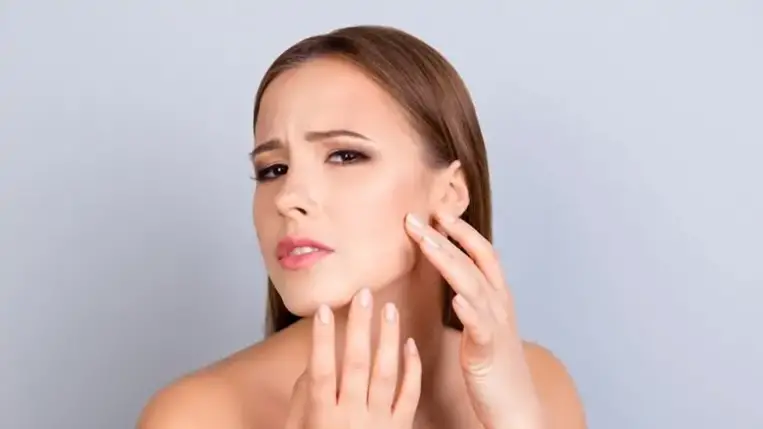 3+1 lépés a pattanásos bőr kezelésére