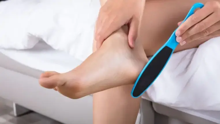 Így kezelhetjük a kirepedezett sarkakat