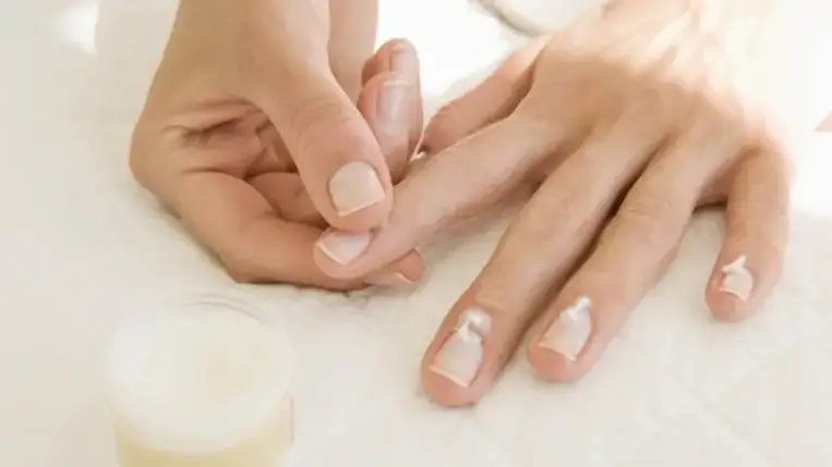 Pikkelysömör a körmön: mutatjuk, mi segíthet