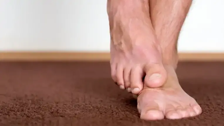 A lábfej ezért viszket