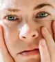 A bőrünkön is nyomot hagy a stressz – ezek a figyelmeztető jelek